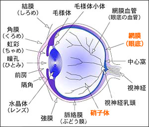 原因 網膜 剥離